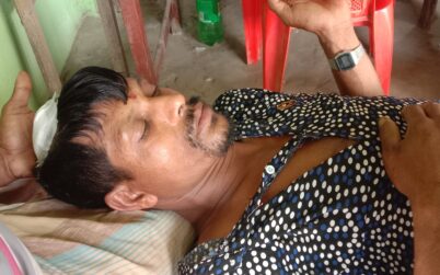কয়রায় পুর্বের শত্রুতার জের ধরে যুবককে হাতুড়ি দিয়ে মাথা ফাটালো প্রতিপক্ষ